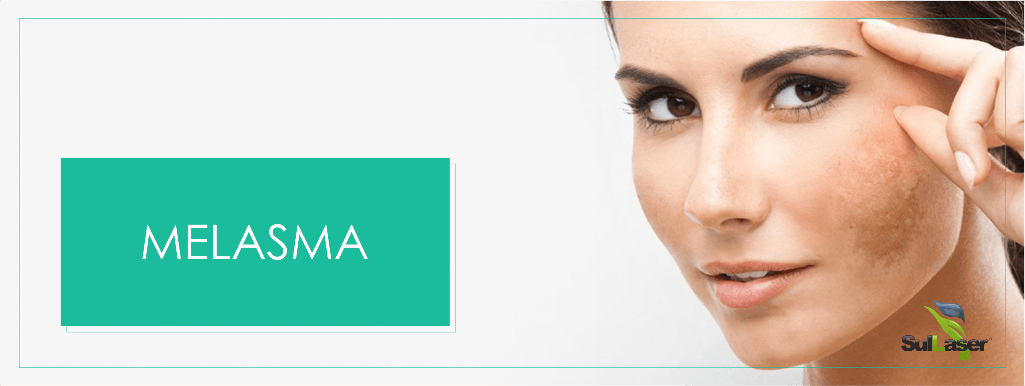 Read more about the article Saiba mais sobre melasma, a mancha que assombra tantas mulheres.