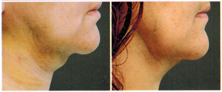 antes-e-depois-delight-1