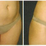antes-e-depois-delight-2