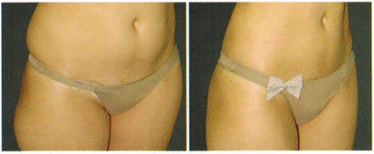 antes-e-depois-delight-2