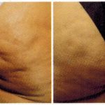 antes-e-depois-delight-3