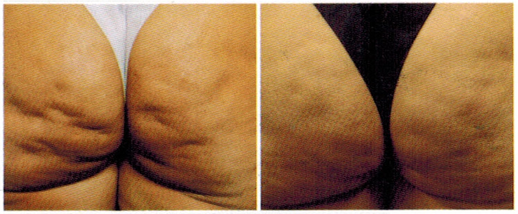 antes-e-depois-delight-3