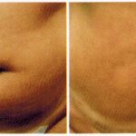 antes-e-depois-delight-6