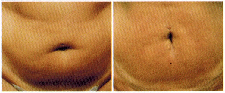 antes-e-depois-delight-6