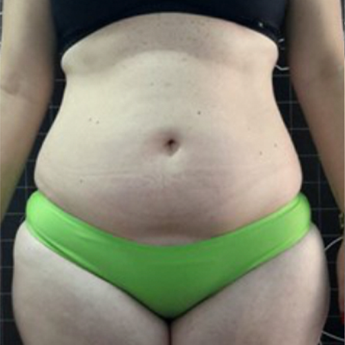 Alugue o aparelho BHS 156 Alugue o aparelho BHS 156